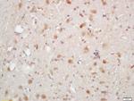 Phospho-AKT1/2/3 (Thr305, Thr308, Thr309) Antibody in Immunohistochemistry (Paraffin) (IHC (P))