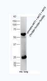 Phospho-AKT1/2/3 (Thr305, Thr308, Thr309) Antibody in Western Blot (WB)