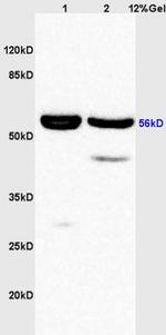 Phospho-AKT1/2/3 (Tyr315, Tyr316, Tyr312) Antibody in Western Blot (WB)