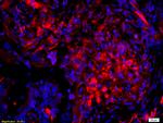 Phospho-AKT1/2/3 (Ser472) Antibody in Immunohistochemistry (Paraffin) (IHC (P))