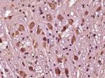 Phospho-Bcl-2Thr129 (Thr129) Antibody in Immunohistochemistry (Paraffin) (IHC (P))