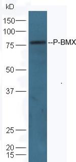 Phospho-BMX (Tyr566) Antibody in Western Blot (WB)