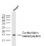 Cardiodilatin-related peptide Antibody in Western Blot (WB)