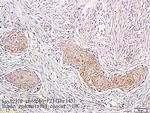 Phospho-CDKN1A (Thr145) Antibody in Immunohistochemistry (Paraffin) (IHC (P))