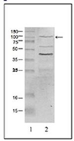 L3MBTL1 Antibody in Western Blot (WB)