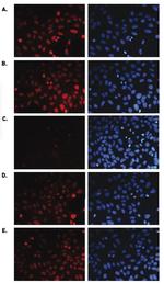 H3K36me1 Antibody in Immunocytochemistry (ICC/IF)