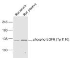Phospho-EGFR (Tyr1110) Antibody in Western Blot (WB)
