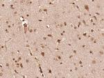 Phospho-FGFR1/FGFR2 (Tyr463, Tyr466) Antibody in Immunohistochemistry (Paraffin) (IHC (P))