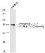 Phospho-FGFR1/FGFR2 (Tyr463, Tyr466) Antibody in Western Blot (WB)