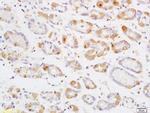 Phospho-mTOR (Thr2446) Antibody in Immunohistochemistry (Paraffin) (IHC (P))