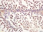 Phospho-GSK-3 Beta (Ser21) Antibody in Immunohistochemistry (Paraffin) (IHC (P))