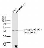 Phospho-GSK-3 Beta (Ser21) Antibody in Western Blot (WB)