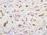 PMVK Antibody in Immunohistochemistry (Paraffin) (IHC (P))