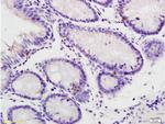 Phospho-IL-1R1 (Tyr496) Antibody in Immunohistochemistry (Paraffin) (IHC (P))