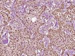 Phospho-CK18 (Ser60) Antibody in Immunohistochemistry (Paraffin) (IHC (P))