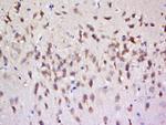 Phospho-Tau protein (Ser356) Antibody in Immunohistochemistry (Paraffin) (IHC (P))