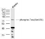 Phospho-Tau protein (Ser356) Antibody in Western Blot (WB)