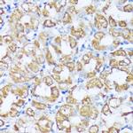 Beclin 1 Antibody in Immunohistochemistry (Paraffin) (IHC (P))