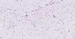 Beclin 1 Antibody in Immunohistochemistry (Paraffin) (IHC (P))