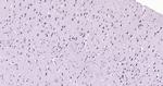 Beclin 1 Antibody in Immunohistochemistry (Paraffin) (IHC (P))