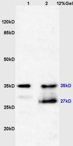 Phospho-NFKBIA (Tyr305) Antibody in Western Blot (WB)