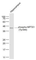 Phospho-NPTX1 (Tyr344) Antibody in Western Blot (WB)