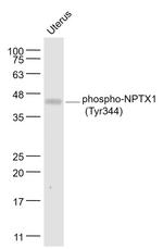 Phospho-NPTX1 (Tyr344) Antibody in Western Blot (WB)