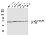 Phospho-PKMYT1 (Thr495) Antibody in Western Blot (WB)