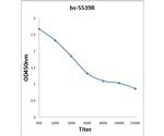 Phospho-FAK (Ser722) Antibody in ELISA (ELISA)