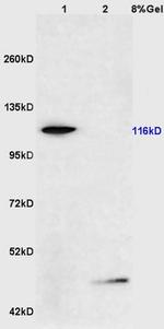 Phospho-FAK (Ser722) Antibody in Western Blot (WB)