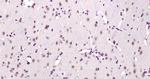 Phospho-AMPK alpha-1 (Thr198) Antibody in Immunohistochemistry (Paraffin) (IHC (P))