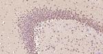 Phospho-AMPK alpha-1 (Thr198) Antibody in Immunohistochemistry (Paraffin) (IHC (P))