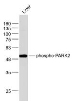 Phospho-PARK2 (Ser378) Antibody in Western Blot (WB)