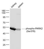 Phospho-PARK2 (Ser378) Antibody in Western Blot (WB)