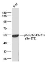 Phospho-PARK2 (Ser378) Antibody in Western Blot (WB)