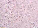 Phospho-PRKCQ (Thr538) Antibody in Immunohistochemistry (Paraffin) (IHC (P))