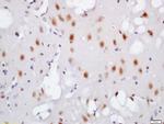 Phospho-TNIK (Ser764) Antibody in Immunohistochemistry (Paraffin) (IHC (P))