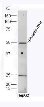 Phospho-TPH (Ser260) Antibody in Western Blot (WB)