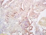 SULT2A1 Antibody in Immunohistochemistry (Paraffin) (IHC (P))