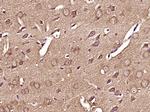 Phospho-RPS6KB1 (Thr412) Antibody in Immunohistochemistry (Paraffin) (IHC (P))