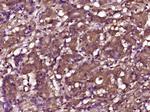 Phospho-RPS6KB1 (Thr412) Antibody in Immunohistochemistry (Paraffin) (IHC (P))