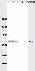 Phospho-RPS6KB1 (Ser427) Antibody in Western Blot (WB)