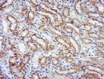 Phospho-RPS6KB1 (Ser441, Thr444) Antibody in Immunohistochemistry (Paraffin) (IHC (P))