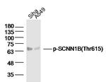 Phospho-SCNN1B (Thr615) Antibody in Western Blot (WB)