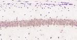 RPL11 Antibody in Immunohistochemistry (Paraffin) (IHC (P))