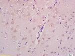 Axin 2 Antibody in Immunohistochemistry (Paraffin) (IHC (P))