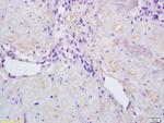 Activin A Receptor Type IC Antibody in Immunohistochemistry (Paraffin) (IHC (P))