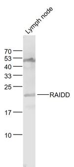 RAIDD Antibody in Western Blot (WB)