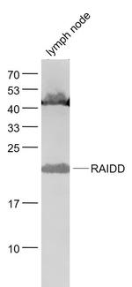 RAIDD Antibody in Western Blot (WB)