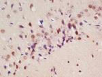 Drebrin Antibody in Immunohistochemistry (Paraffin) (IHC (P))